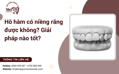 Hô hàm có niềng răng được không? Giải pháp nào tốt? Hô hàm có niềng răng được không? Giải pháp nào tốt?