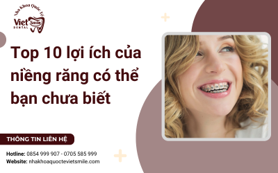 Top 10 lợi ích của niềng răng có thể bạn chưa biết Top 10 lợi ích của niềng răng có thể bạn chưa biết