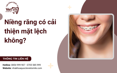 Niềng răng có cải thiện mặt lệch không? Niềng răng có cải thiện mặt lệch không?