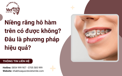 Niềng răng hô hàm trên có được không? Đâu là phương pháp hiệu quả? Niềng răng hô hàm trên có được không? Đâu là phương pháp hiệu quả?