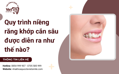 Quy trình niềng răng khớp cắn sâu được diễn ra như thế nào? Quy trình niềng răng khớp cắn sâu được diễn ra như thế nào?