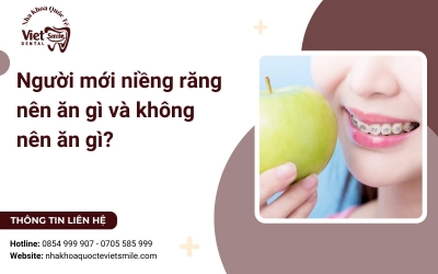 Người mới niềng răng nên ăn gì và không nên ăn gì? Người mới niềng răng nên ăn gì và không nên ăn gì?