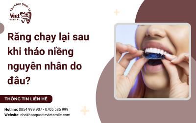 Răng chạy lại sau khi tháo niềng nguyên nhân do đâu? Răng chạy lại sau khi tháo niềng nguyên nhân do đâu?