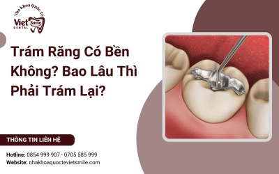 Trám Răng Có Bền Không? Bao Lâu Thì Phải Trám Lại? Trám Răng Có Bền Không? Bao Lâu Thì Phải Trám Lại?