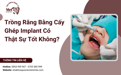 Trồng Răng Bằng Cấy Ghép Implant Có Thật Sự Tốt Không? Trồng Răng Bằng Cấy Ghép Implant Có Thật Sự Tốt Không?
