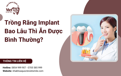 Trồng Răng Implant Bao Lâu Thì Ăn Được Bình Thường? Trồng Răng Implant Bao Lâu Thì Ăn Được Bình Thường?