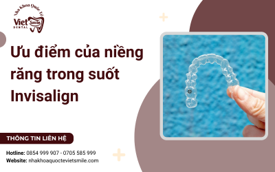 Ưu điểm của niềng răng trong suốt invisalign Ưu điểm của niềng răng trong suốt invisalign