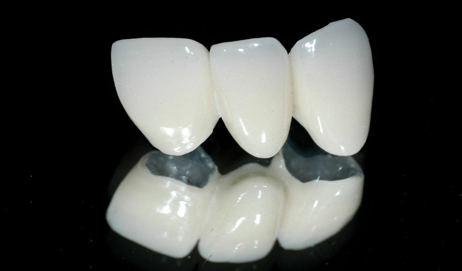 Răng Sứ Ceramill Là Gì? Của Nước Nào? Giá Bao Nhiêu?