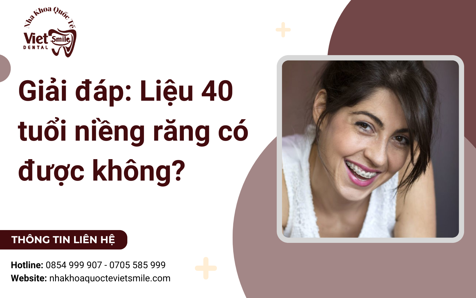 Giải đáp: Liệu 40 tuổi niềng răng có được không?