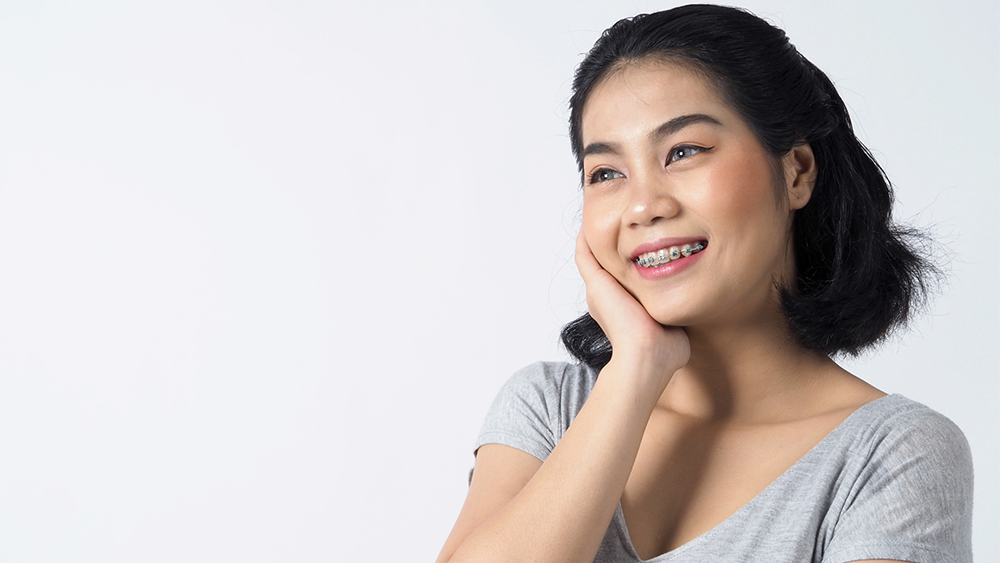 Người 40 tuổi niềng răng có lâu không?