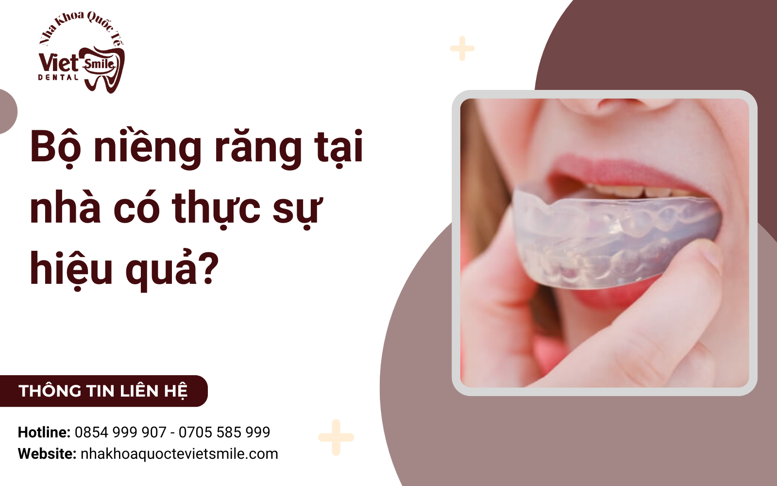 Bộ niềng răng tại nhà có thực sự hiệu quả?