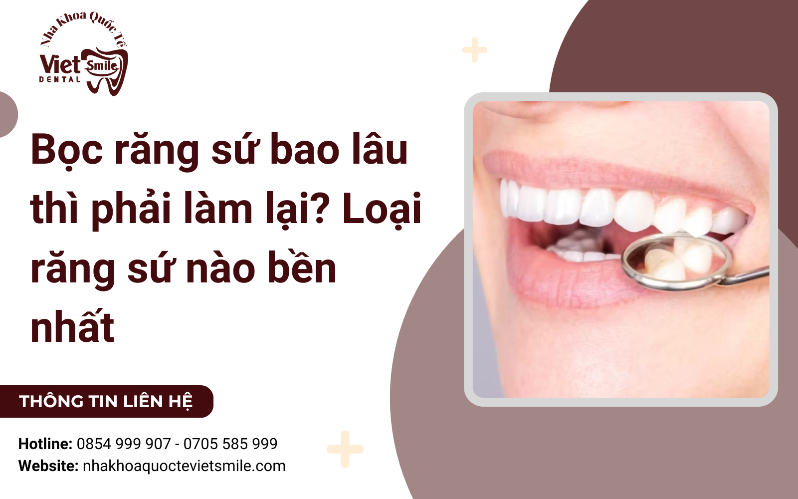 Bọc răng sứ bao lâu thì phải làm lại? Loại răng sứ nào bền nhất
