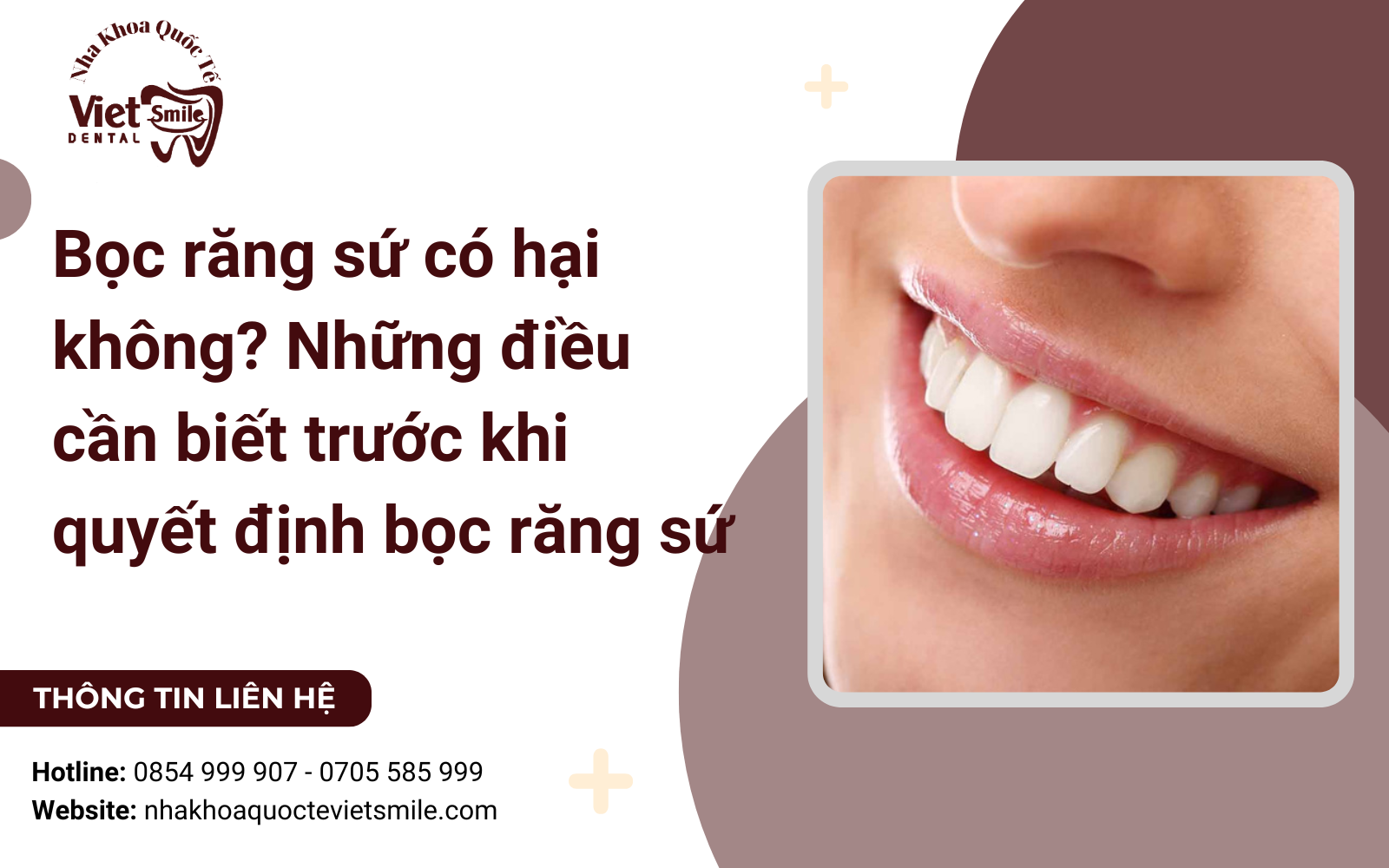 Bọc răng sứ có hại không? Những điều cần biết trước khi quyết định bọc răng sứ
