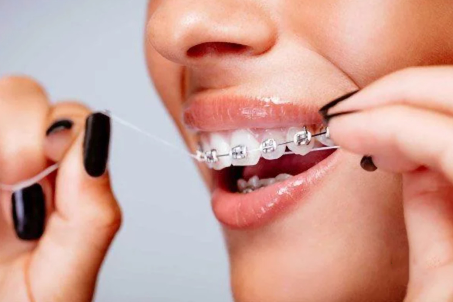 Dùng chỉ tơ nha khoa