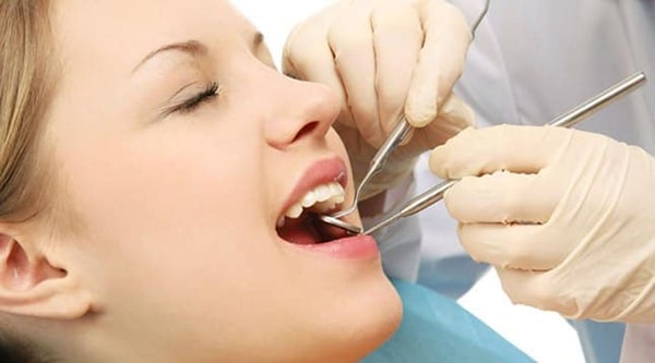 Các câu hỏi thường gặp có nên trồng răng sứ không