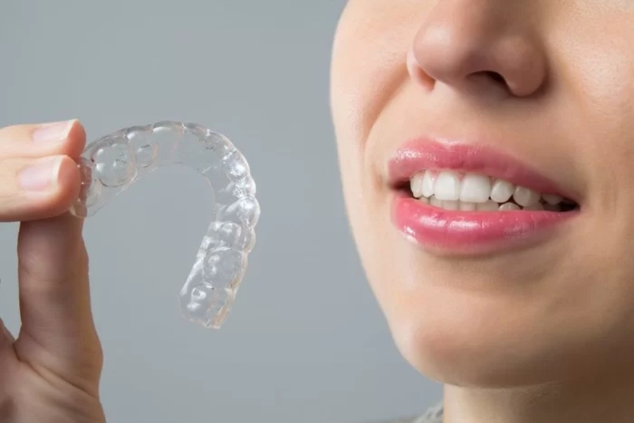 Niềng răng trong suốt Invisalign