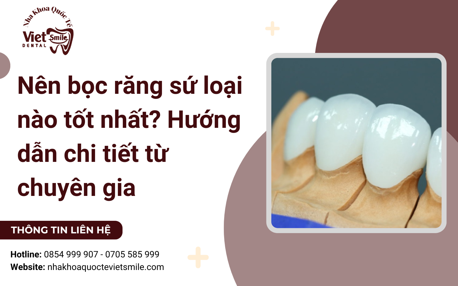 Nên bọc răng sứ loại nào tốt nhất? Hướng dẫn chi tiết từ chuyên gia