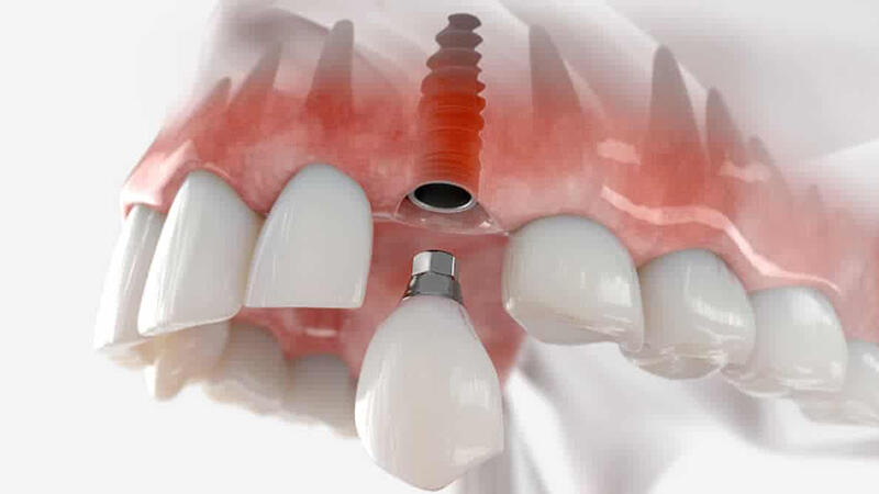 Các phương pháp điều trị
