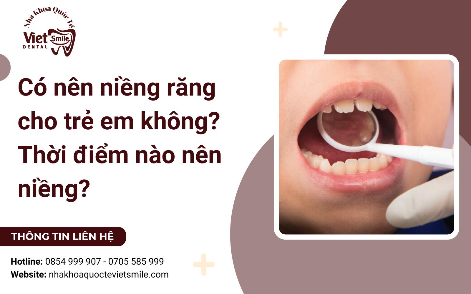 Có nên niềng răng cho trẻ em không? Thời điểm nào nên niềng?