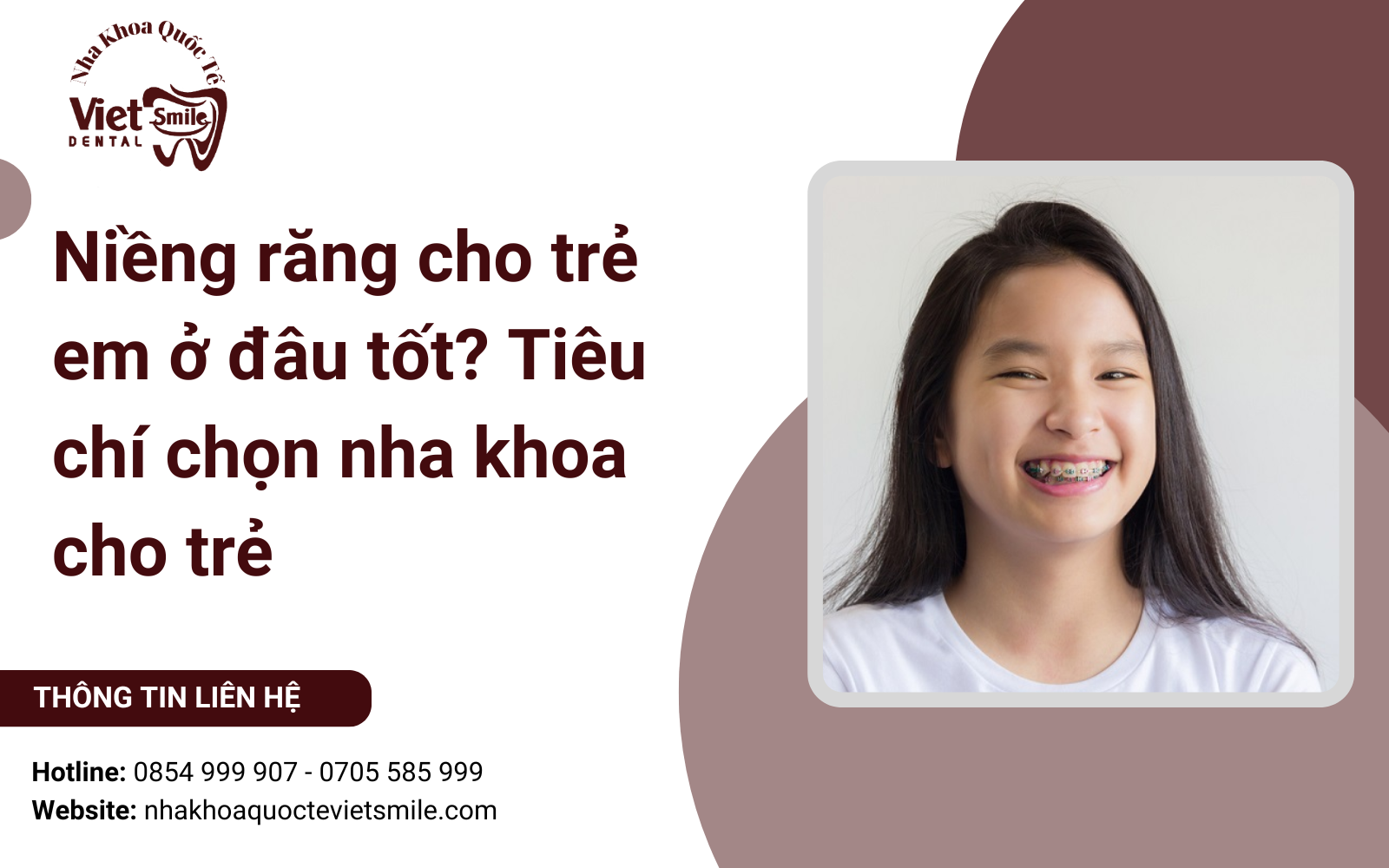 Niềng răng cho trẻ em ở đâu tốt? Tiêu chí chọn nha khoa cho trẻ