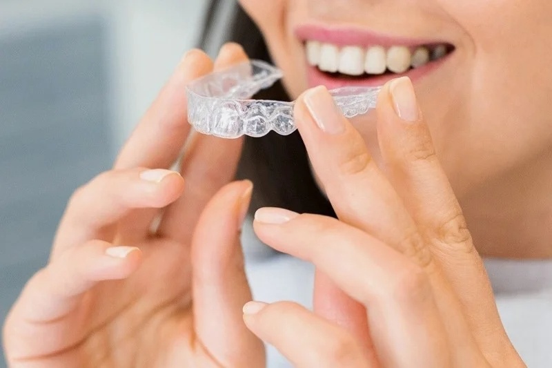 Niềng răng trong suốt Invisalign – Giải pháp thẩm mỹ tối ưu, kín đáo để cải thiện mặt lệch
