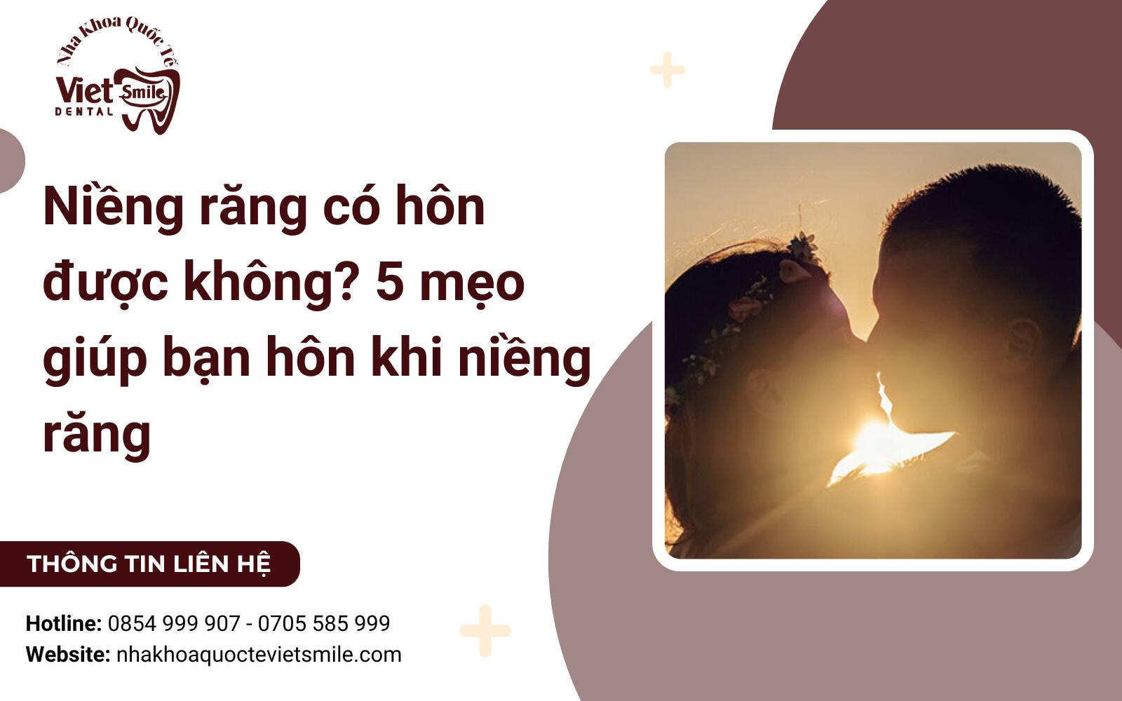 Niềng răng có hôn được không? 5 mẹo giúp bạn hôn khi niềng răng