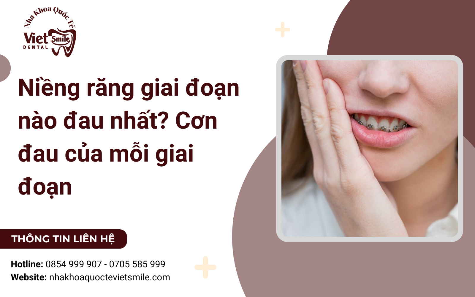 Niềng răng giai đoạn nào đau nhất? Cơn đau của mỗi giai đoạn