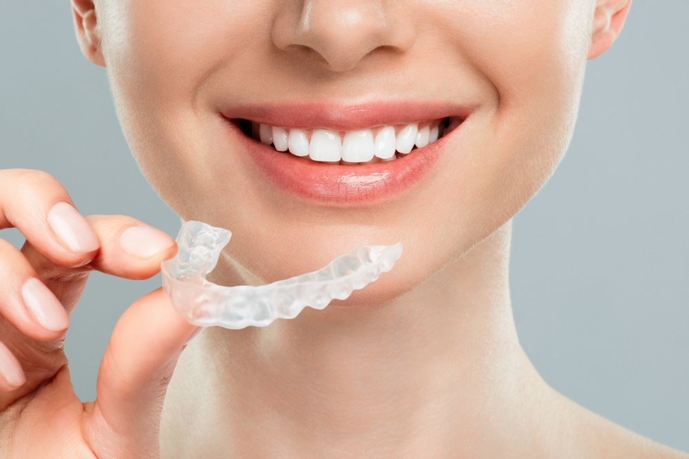 Đối tượng nào phù hợp với niềng răng Invisalign?
