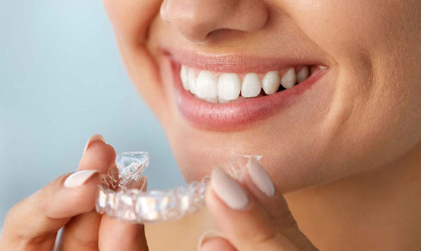 Quy trình thực hiện niềng răng invisalign