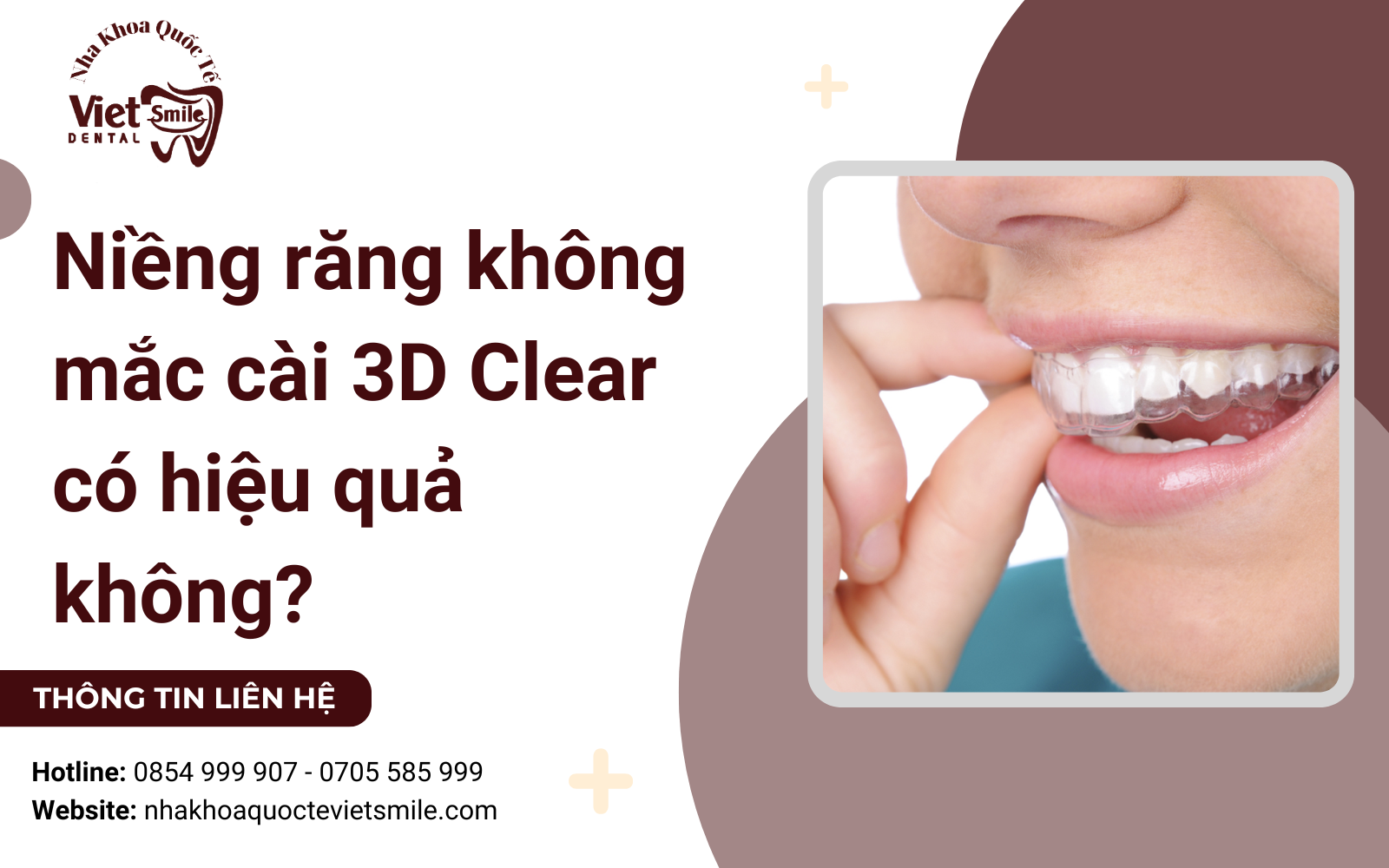 Niềng răng không mắc cài 3D Clear có hiệu quả không?