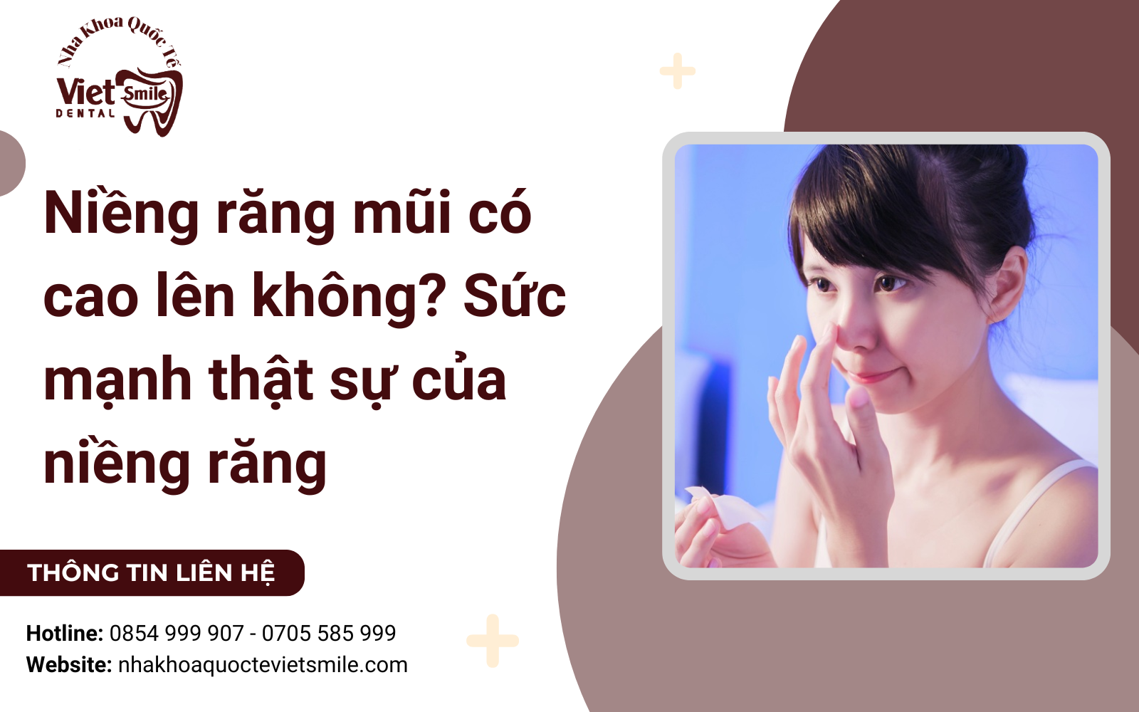 Niềng răng mũi có cao lên không? Sức mạnh thật sự của niềng răng