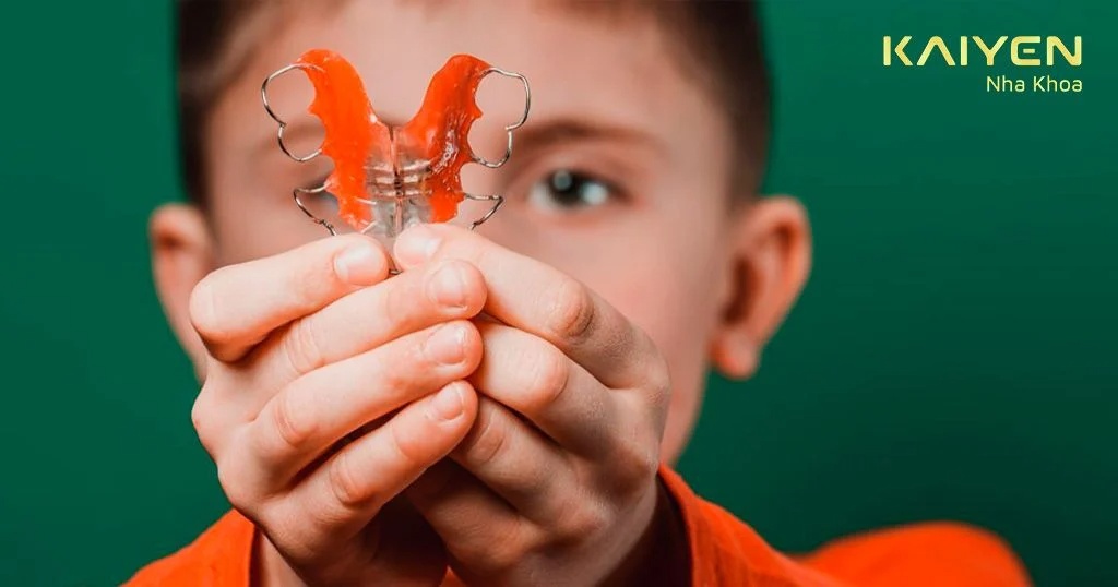 Niềng răng tháo lắp trẻ em là gì?