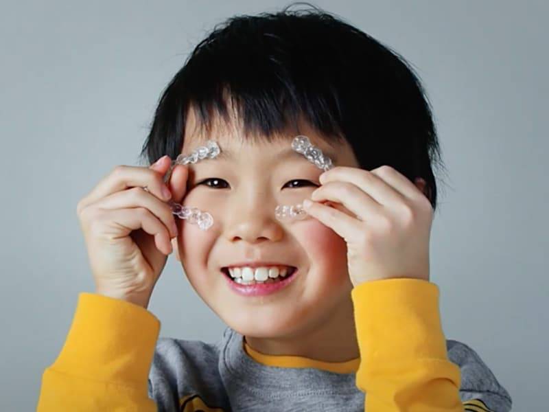 Niềng răng tháo lắp trong suốt Invisalign
