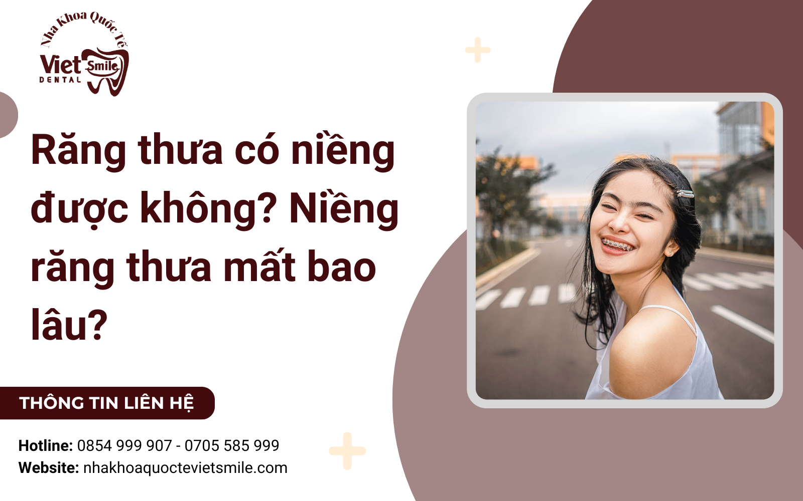 Răng thưa có niềng được không? Niềng răng thưa mất bao lâu?