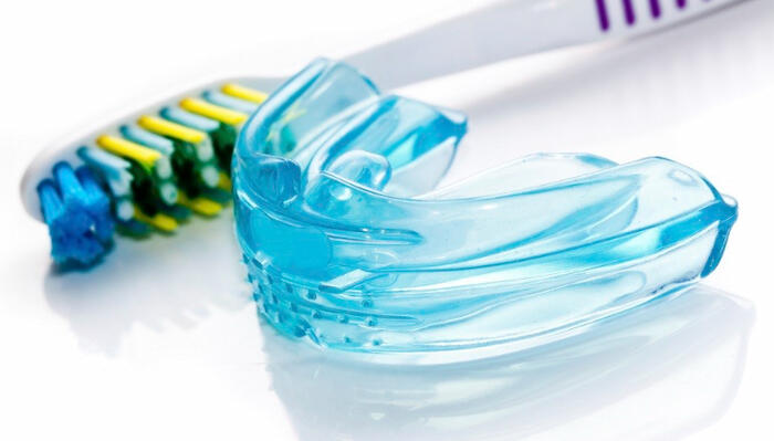 Niềng răng trainer là gì?