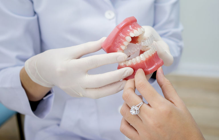 Quy trình niềng răng vô hình Zenyum