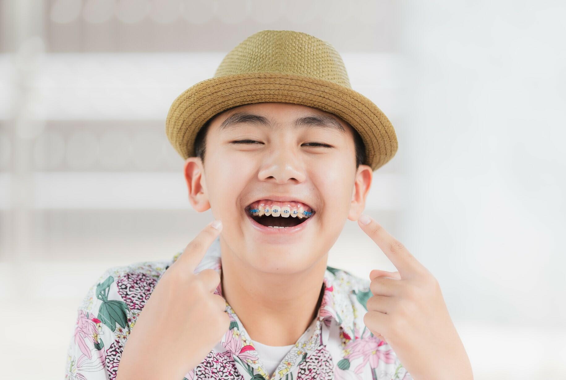 Tại sao cần giúp trẻ cân bằng tâm lý khi niềng răng?