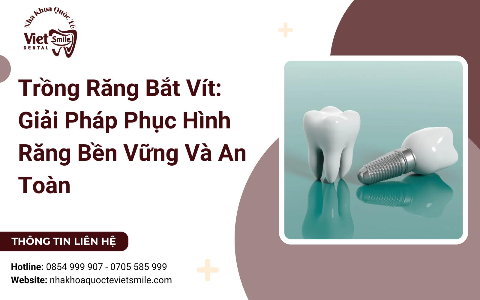 Trồng Răng Bắt Vít: Giải Pháp Phục Hình Răng Bền Vững Và An Toàn